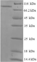 Albumin (ALB), Macaca fascicularis, recombinant