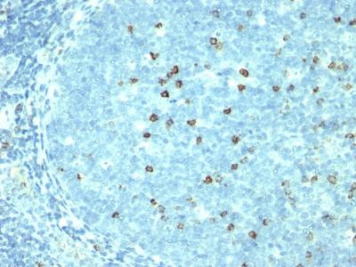 Anti-CD57 / B3GAT1 (Natural Killer Cell Marker)(Clone: SPM527)