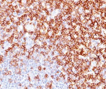 Anti-CD45RO (T-cell marker), clone UCHL-1