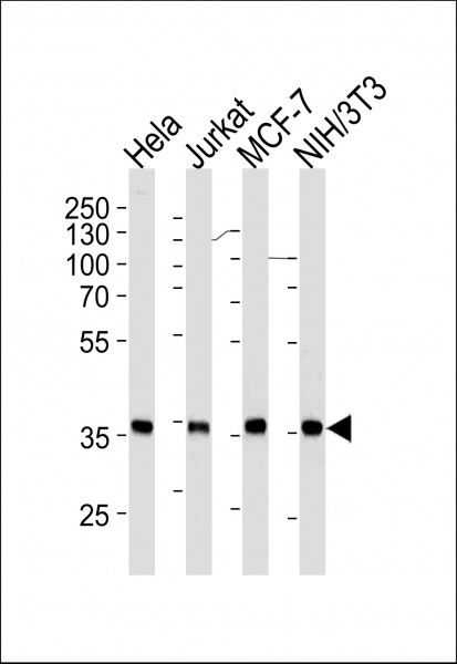 Anti-NPM1, clone 1042CT5.2.1