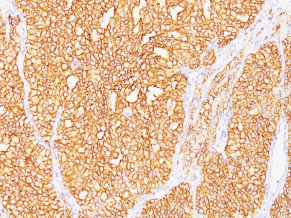 Anti-Renal Cell Carcinoma / gp200 (Carbonic Anhydrase IX), clone SPM487