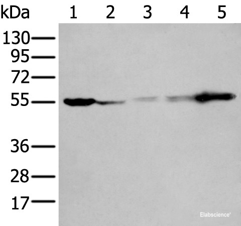 Anti-PFKFB3