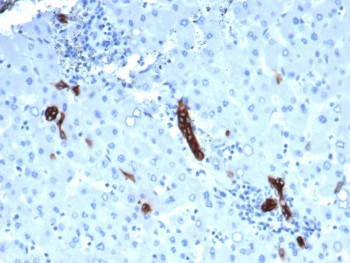 Anti-TROP2 / TACSTD2, clone rTACSTD2/6395