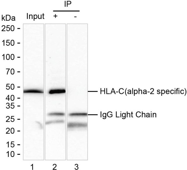Anti-HLA-C (recombinant antibody)