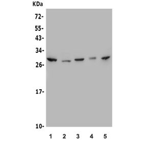 Anti-MESP1 / Mesoderm Posterior Protein 1