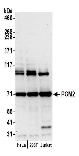 Anti-PGM2