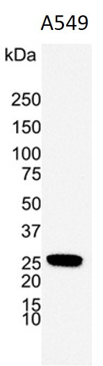 Anti-UCHL1 / PGP9.5, clone 31A3