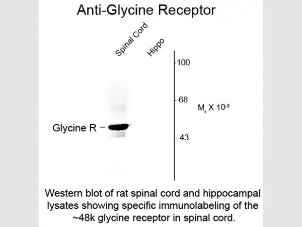 Anti-Glycine Receptor