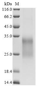 IGF-like family receptor 1 (Igflr1), partial, mouse, recombinant