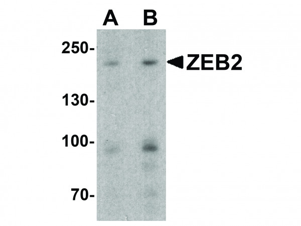 Anti-ZEB2