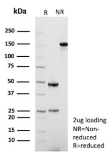 Anti-TGFB1 / Transforming growth factor beta 1, clone rTGFB17