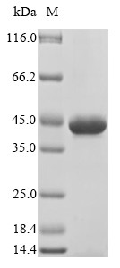 Filamin-A (FLNA), partial, human, recombinant