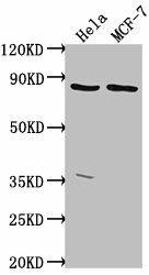 Anti-TTC39B