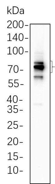 Anti-Recombinant FOXP1, clone 3P11