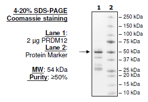 PRDM12, N-terminal GST-tag, human recombinant protein