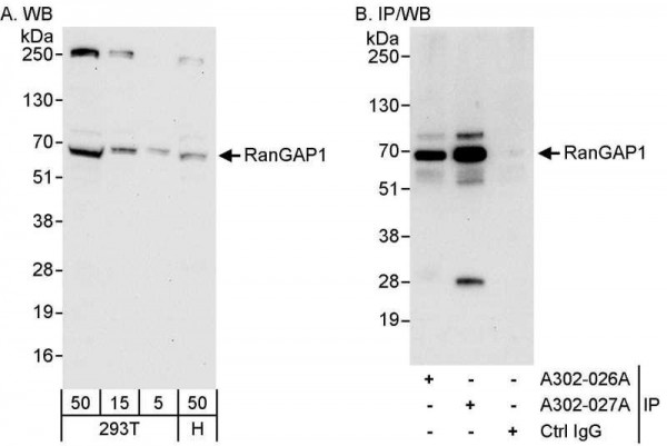 Anti-RanGAP1