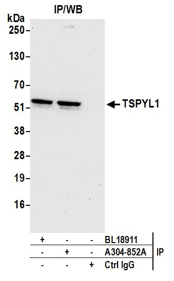 Anti-TSPYL1