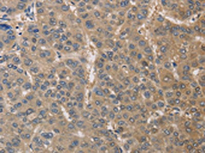 Anti-DPYSL3