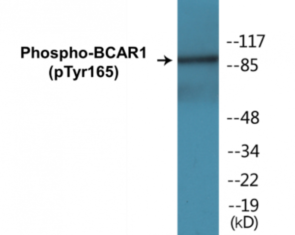 BCAR1 (Phospho-Tyr165) Colorimetric Cell-Based ELISA Kit