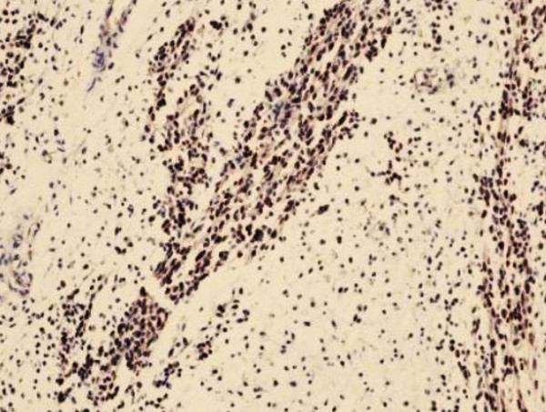 Anti-MyoD, clone SQab20201