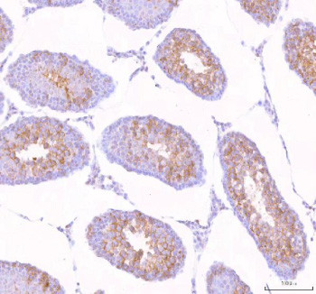 Anti-STK31 / Serine/threonine-protein kinase 31