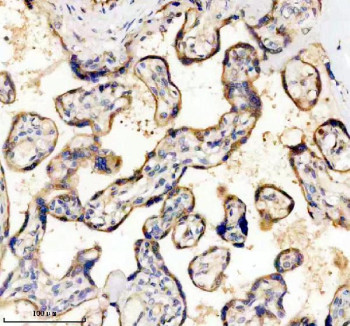 Anti-CD39 / ENTPD1, clone 17E43
