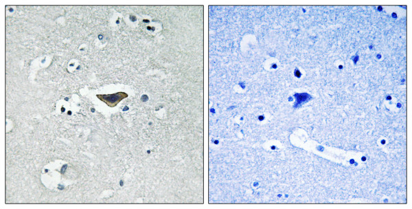 Anti-phospho-RASGRF1 / CDC25 (Ser916)