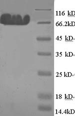 Microtubule-associated protein tau (Mapt), rat, recombinant