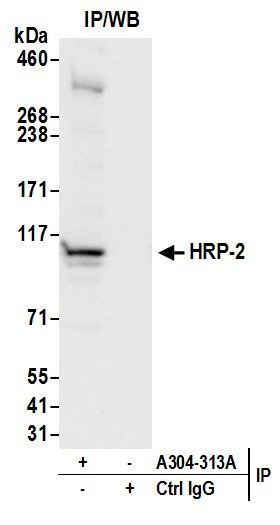 Anti-HRP-2