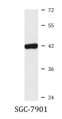 Anti-ST8sia1