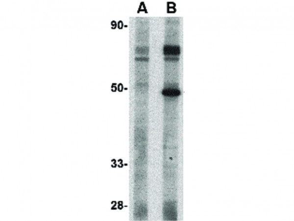 Anti-TSLP Receptor