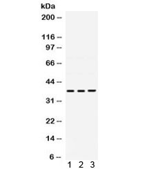 Anti-DNA polymerase beta / POLB