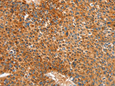 Anti-ALDH1A2