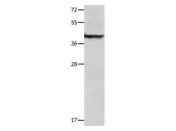 Anti-SERPINB5