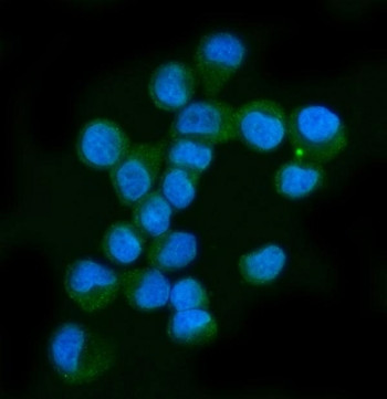 Anti-Neurofibromin Antibody / NF1