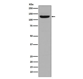 Anti-Collagen I / COL1A1, clone AFD-3