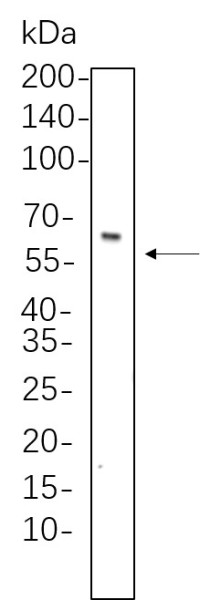 Anti-Recombinant Smad4, clone 5B11