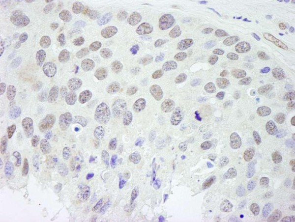 Anti-RBM9 (IHC)