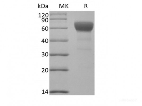 Transforming Growth Factor-Beta Receptor Type II/TGFBR2 (C-Fc) (recombinant mouse)