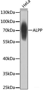 Anti-Placental Alkaline Phosphatase