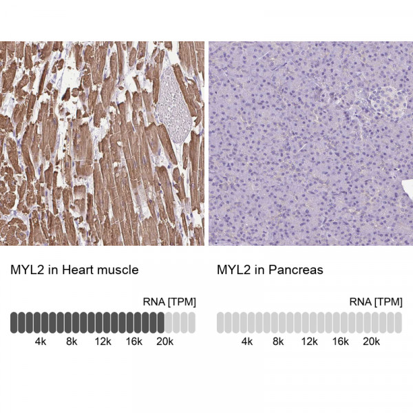 Anti-MYL2