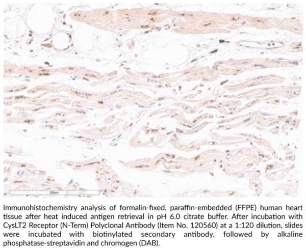 Anti-CysLT2 Receptor (N-Term)