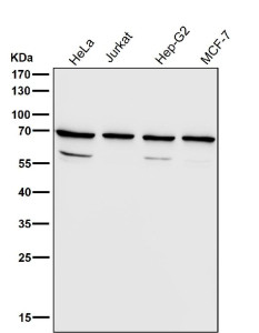 Anti-RPN1 / Ribophorin I, clone 32R32
