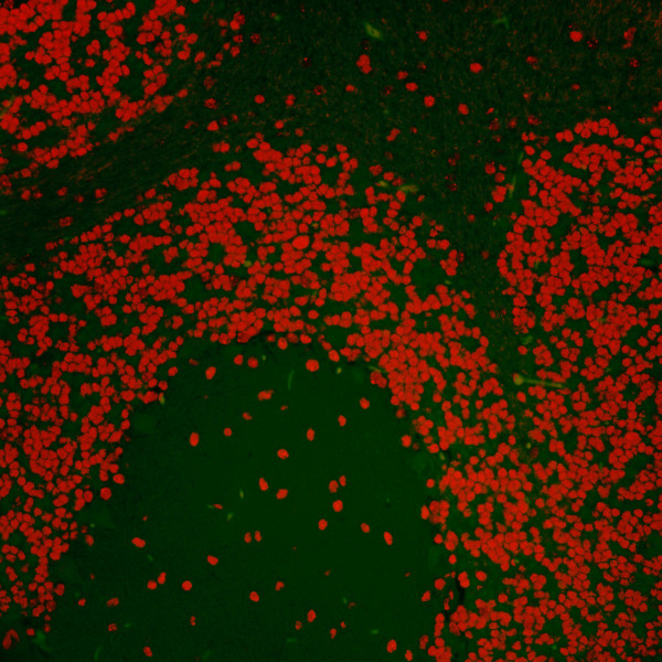 Anti-Nucleolin (NCL)