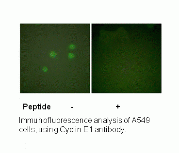 Anti-Cyclin E1
