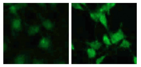Anti-phospho-p70 S6 Kinase (Thr389)