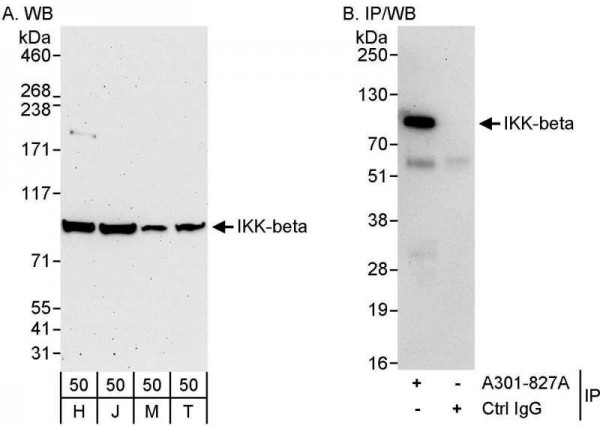 Anti-IKK-beta