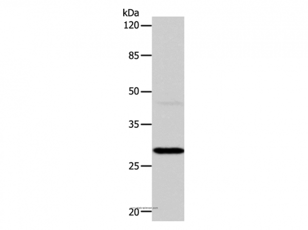 Anti-CA1