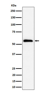 Anti-PNKP / Polynucleotide kinase 3 phosphatase, clone 30P00