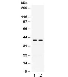 Anti-ADA / Adenosine deaminase